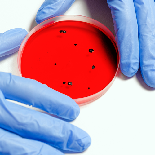 Github link to Diagnose Virus Project